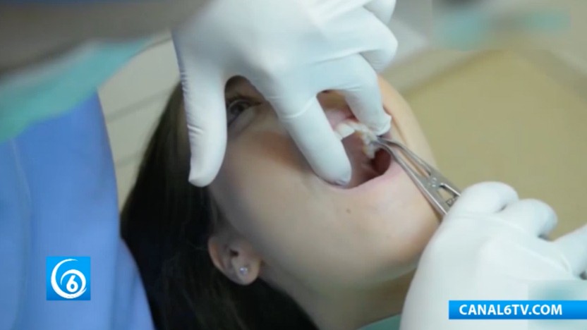 Cápsula Por Su Salud. Enfermedad Periodontal