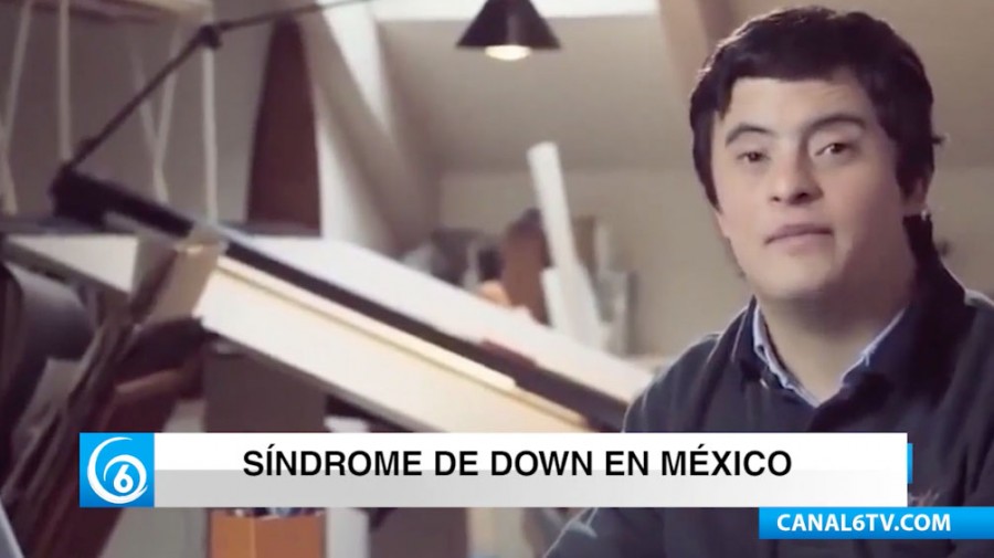 El Sindrome de Dawn en México