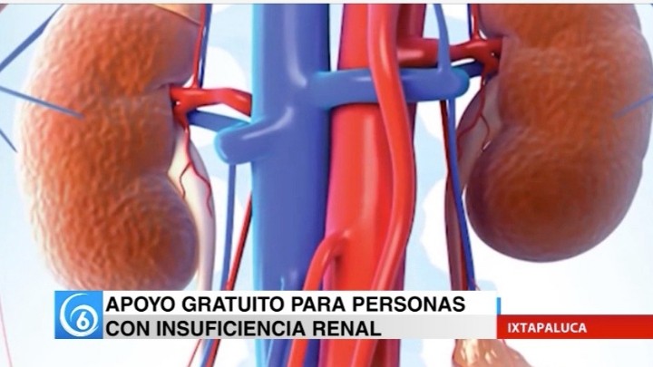 El DIF del municipio de Ixtapaluca apoya gratuitamente a personas con insuficiencia renal