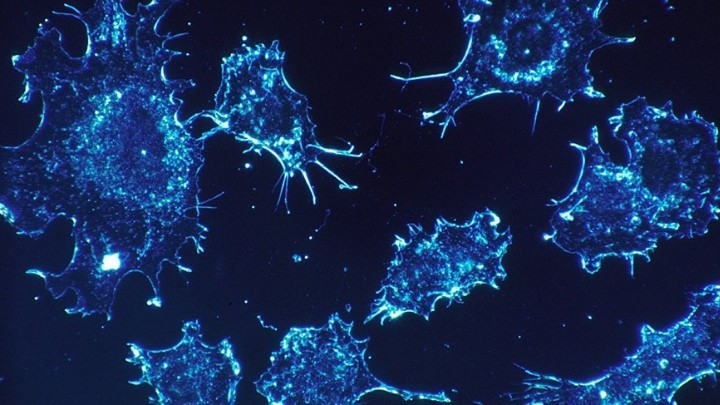 Científicos hallaron mecanismo que detienen el desarrollo del cáncer