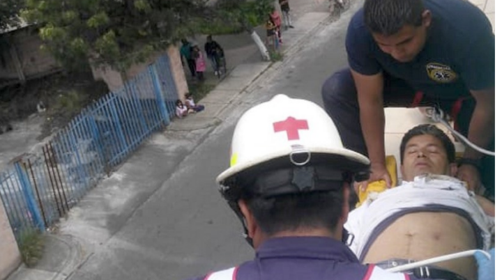 Hombre sobrevive a una descarga eléctrica en Chalco