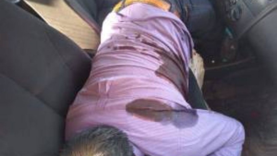 Balean a un hombre por resistirse a un asalto en el EdoMex