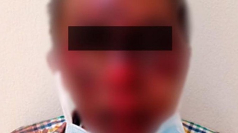 Le dan golpiza a agresor de mujer en Coacalco