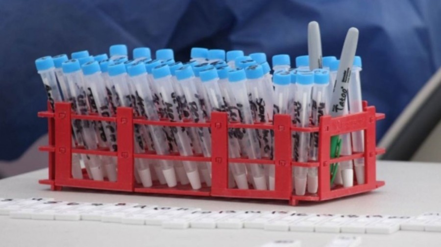 Roban vehículo con muestras de pacientes sospechosos a Covid-19