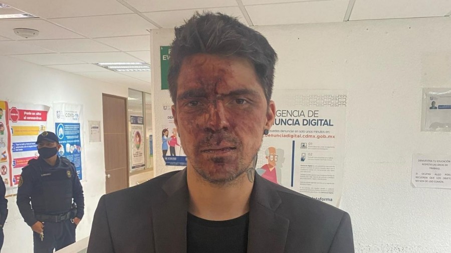 Hijo de Lupita D´Alessio denuncia golpiza de exgoberandor del EdoMex