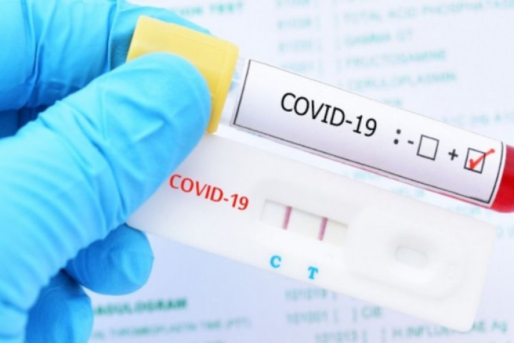 Confirman contagio de cepa británica de Covid-19 en GTO