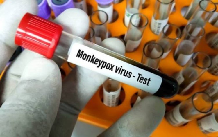 ​¿Qué tan grave es la viruela del mono y cuales son los síntomas?