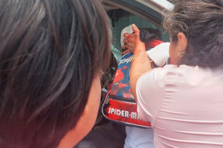 Niño queda gravemente herido tras ataque de perro en Jiutepec, Morelos