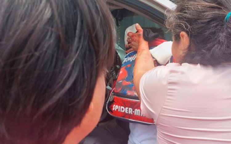 Niño queda gravemente herido tras ataque de perro en Jiutepec, Morelos