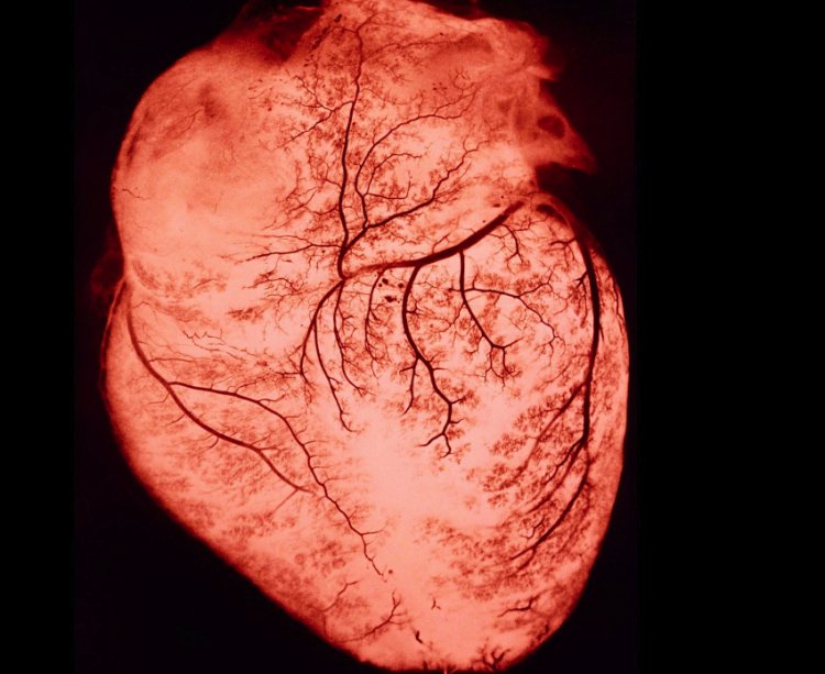 Científicos descubren afectaciones cardiacas a largo plazo a causa del Covid-19