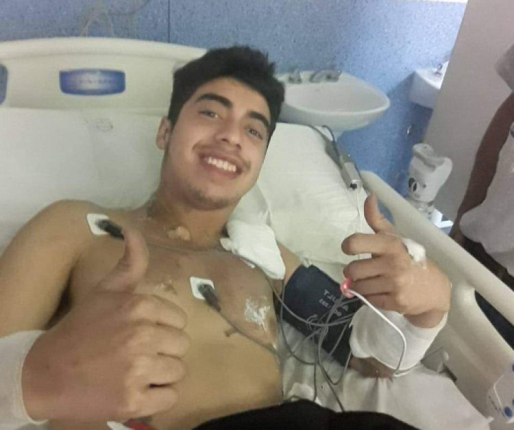 Joven sobrevive tras caerle un rayo en San Luis, Argentina
