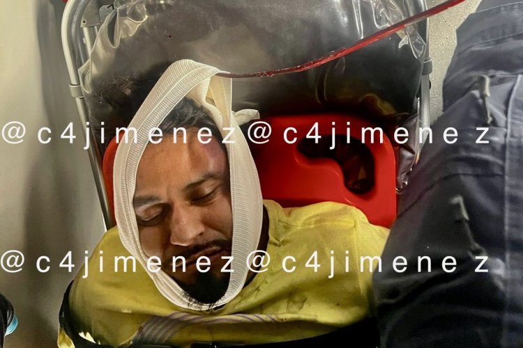 Hombre es atacado con una varilla por orinarse en la vía pública en la CDMX
