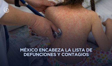 Emiten alerta epidemiológica por sarampión en todo el continente americano