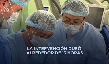 Médicos de China y Rusia logran primer trasplante bilateral de manos