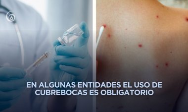 Refuerzan medidas en varios estados ante brote de sarampión en México